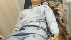 Ibu dan Anak Jatuh di Bawah Perlintasan Skywalk Bogor, Luka Parah Akibat Jalan Berlubang